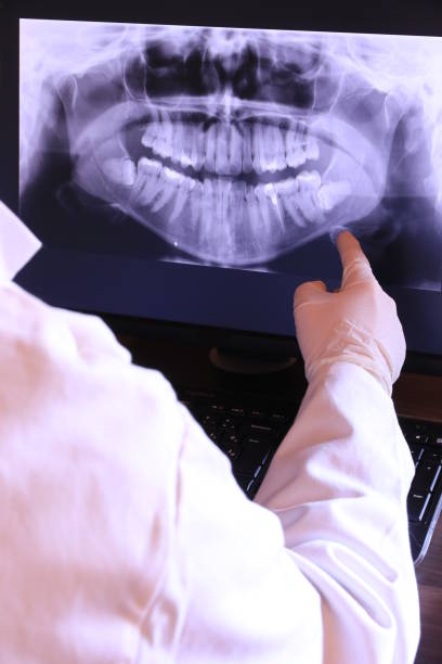 Best Emergency Dental Care for Broken or Chipped Teeth in Edison, GA